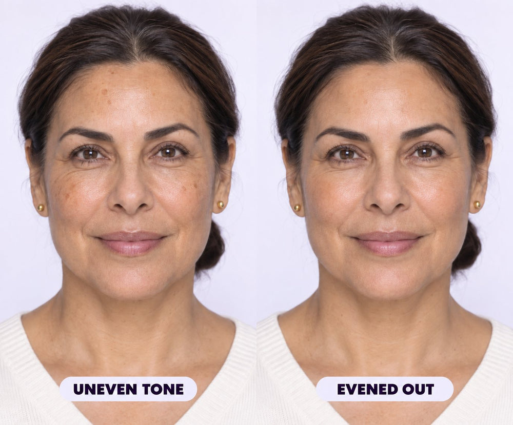 Uneven tone evened out