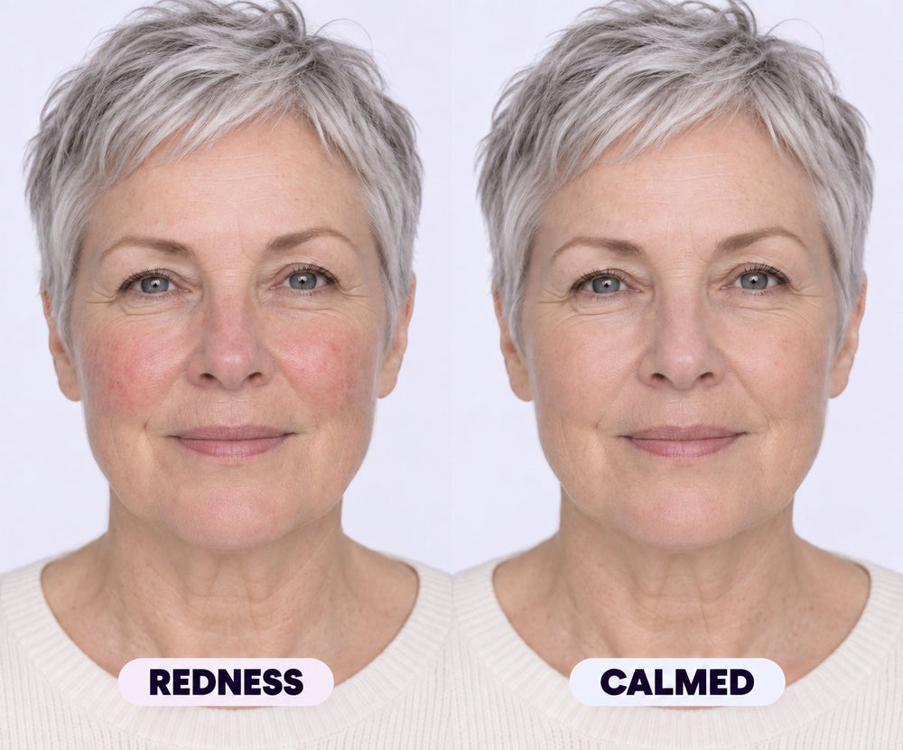 Redness calmed