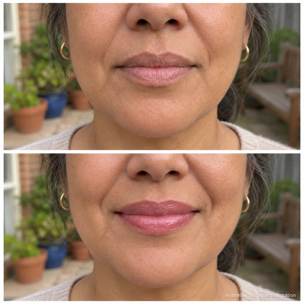 Lips before and after the hueme Adaptive Lip (model demonstration)